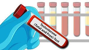testosterone and type 2 diabetes