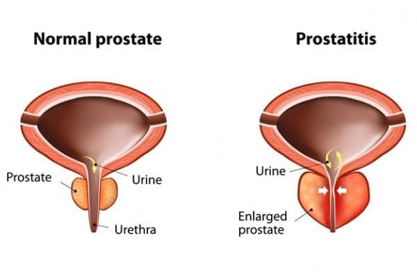 You are currently viewing Prostate Health Care and Sex Life: What’s the Connection You Need To Know?
